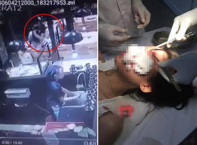 Nam Định: Hai cô gái bị nam thanh niên ném cốc, đánh túi bụi ở quán ăn - Ảnh 1.