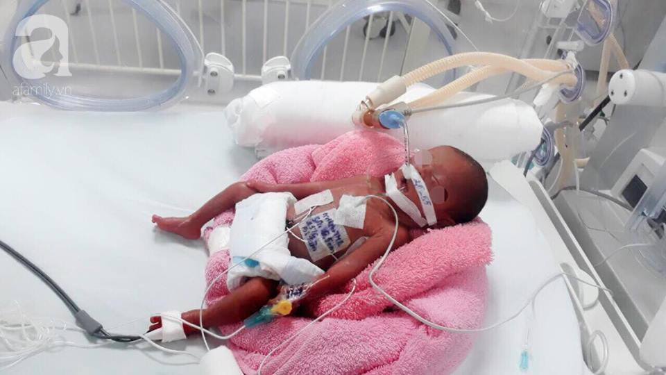 TP.HCM: Bé gái sơ sinh nặng chỉ 600 gram, tổn thương tim nguy kịch được cứu sống 'thần kỳ' 1