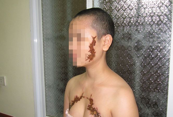 Từ sự việc Nga vọc bạo hành người giúp việc đến sảy thai, nhìn lại những vụ tra tấn dã man từng chấn động dư luận cả nước - Ảnh 8. Từ sự việc Nga 'vọc' bạo hành người giúp việc đến sảy thai, nhìn lại những vụ tra tấn dã man từng chấn động dư luận cả nước 9