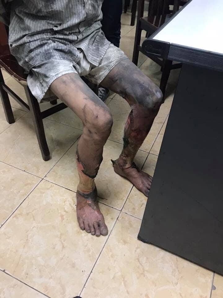 Hé lộ nguyên nhân rể cũ đến đổ xăng đốt nhà và đâm bố vợ bị thương ở Hà Nội - Ảnh 2. Hé lộ nguyên nhân rể cũ mang xăng đốt nhà và đâm bố vợ bị thương ở Hà Nội 2