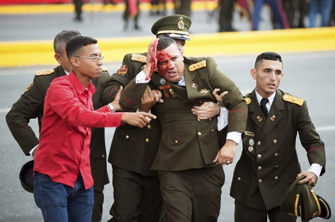 7 ngày qua ảnh: Binh sĩ đổ máu trong vụ ám sát hụt Tổng thống Venezuela - Ảnh 5. 7 ngày qua ảnh: Binh sĩ đổ máu trong vụ ám sát hụt Tổng thống Venezuela 5