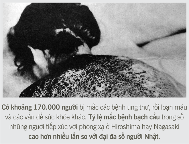 [Photo Story] Những hồi ức về thảm họa nguyên tử kinh hoàng nhất trong lịch sử - Ảnh 9.