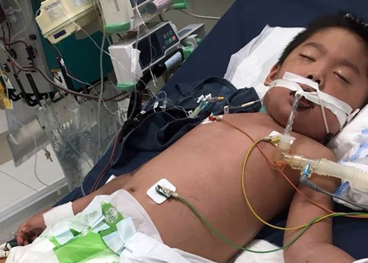 Hà Nội: Bé trai 7 tuổi đang khoẻ mạnh bỗng hôn mê vì suy đa tạng, nhiễm trùng máu sau trận sốt cao - Ảnh 3.