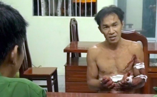 Kẻ giết hàng xóm rồi chặt đầu ở miền Tây thoát án vì bị tâm thần - Ảnh 2. Kẻ giết hàng xóm rồi chặt đầu ở miền Tây thoát án vì bị tâm thần 2