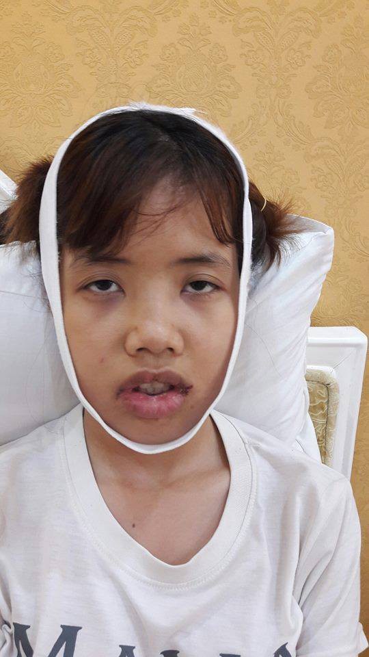 Đập đi xây lại 3 lần trong 6 tháng: Hành trình lột xác của cô gái từng bị đuổi việc vì quá xấu gây sốt MXH - Ảnh 4. 'Đập đi xây lại' 3 lần trong 6 tháng: Hành trình lột xác của cô gái từng bị đuổi việc vì quá xấu gây sốt MXH 4