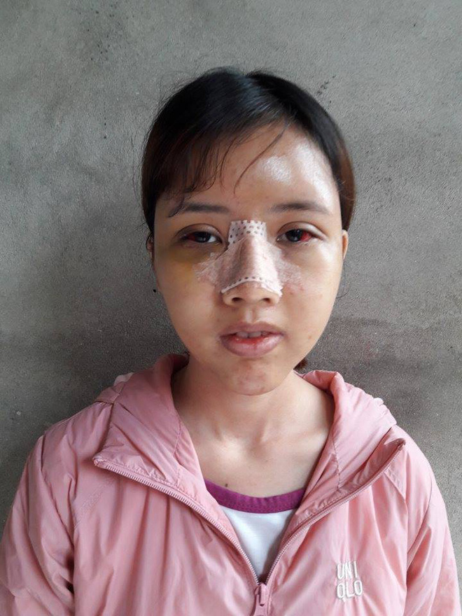 Đập đi xây lại 3 lần trong 6 tháng: Hành trình lột xác của cô gái từng bị đuổi việc vì quá xấu gây sốt MXH - Ảnh 5. 'Đập đi xây lại' 3 lần trong 6 tháng: Hành trình lột xác của cô gái từng bị đuổi việc vì quá xấu gây sốt MXH 5