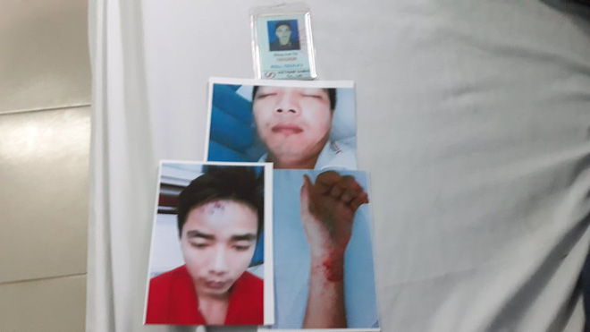 Công nhân tố bị công an xã đánh đập, còng tay vì... 11 đôi giầy - Ảnh 1. Công nhân 'tố' bị công an xã đánh đập, còng tay vì... 11 đôi giầy 1