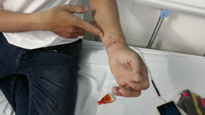 Công nhân tố bị công an xã đánh đập, còng tay vì... 11 đôi giầy - Ảnh 2. Công nhân 'tố' bị công an xã đánh đập, còng tay vì... 11 đôi giầy 2