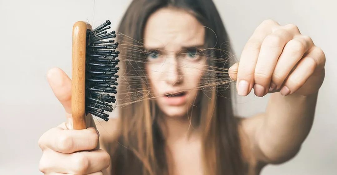 5 dấu hiệu khác thường ở mái tóc đang ngầm cảnh báo một loạt vấn đề sức khỏe xảy ra trong cơ thể bạn - Ảnh 1.