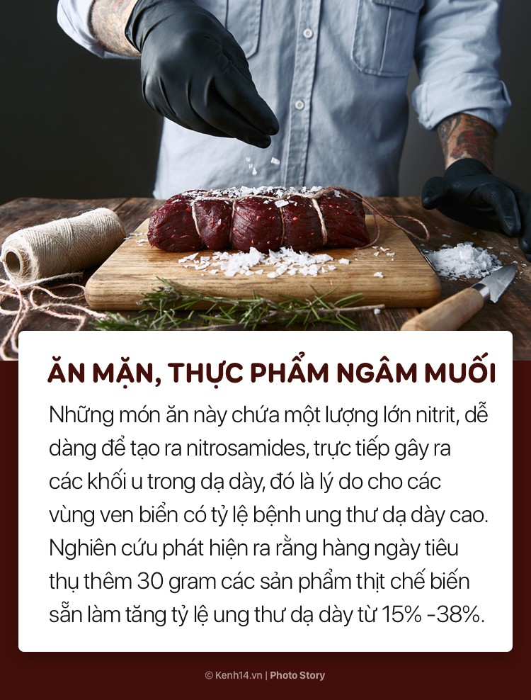 Cần chú ý những nguyên nhân gây ung thư dạ dày dưới đây để bảo vệ sức khoẻ - Ảnh 1.