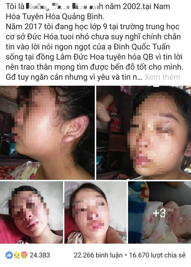 Vụ người mẹ 16 tuổi tố bị chồng bạo hành, người chồng bất ngờ nói Vụ người mẹ 16 tuổi tố bị chồng bạo hành, người chồng bất ngờ nói