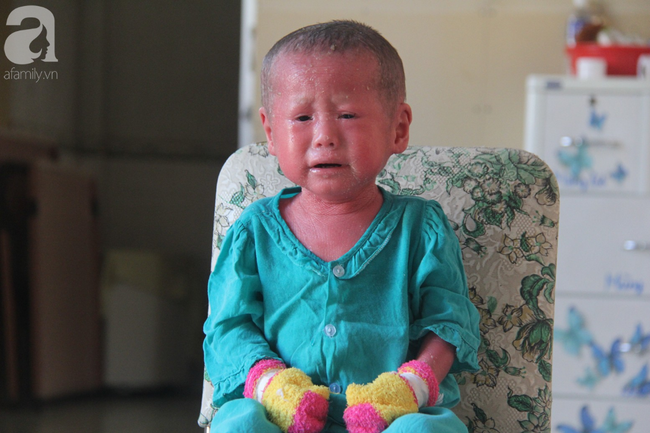 Hình ảnh mới nhất của bé Bích bị bỏ rơi, người đầy vẩy ngứa như da trăn sau đợt khám bệnh đầu tiên tại Singapore - Ảnh 12.