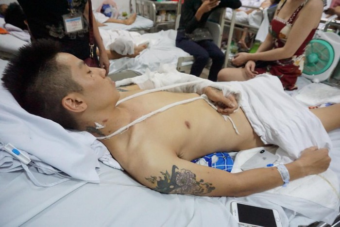 Nhóm đối tượng chém nát chân nam thanh niên ở Phú Thọ: Dằn mặt vì tranh giành đào hát 2