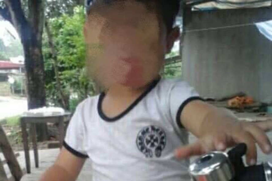 Vụ bé trai 5 tuổi tử vong bất thường sau khi cắt amidan: Hé lộ nguyên nhân 1