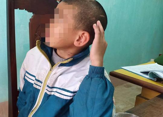 Những hình ảnh xót xa trong vụ bé trai bị sư thầy đánh bầm tím người ở Thanh Hóa 5