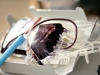 Hàn Quốc tiến hành điều trị bằng huyết tương trên bệnh nhân nhiễm Mers