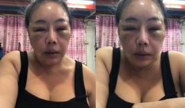 Nữ đại gia Thái Lan 'đổi chồng như thay áo' năm nào gây sốc với gương mặt sưng vù vì bị chồng mới đánh đập?