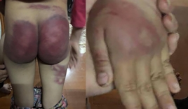 Bé gái 8 tuổi bị bạo hành ở Thanh Hóa: Bố trói hai tay vào cột nhà và dùng roi tre đánh rất mạnh