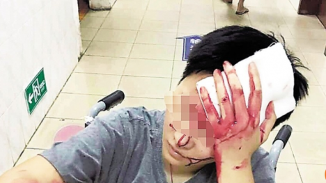 Thực khách Trung Quốc bị nhân viên giao hàng hành hung chảy máu đầu
