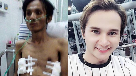 Sau 3 năm, Thái Lan Viên xuất hiện điển trai sau khi bị hủy hoại phổi 95 \%