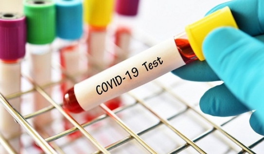 Hà Nội: Bệnh nhân nhiễm Covid-19 dương tính trở lại sau 3 ngày ra viện