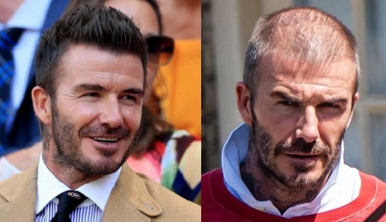 Beckham lộ ảnh bị hói, nhan sắc tiều tụy ở tuổi 45 