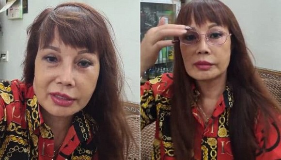 Cô dâu 62 tuổi khiến dân tình dụi mắt nhiều lần vì nhan sắc hậu trùng tu: Biến dạng khó tin 6