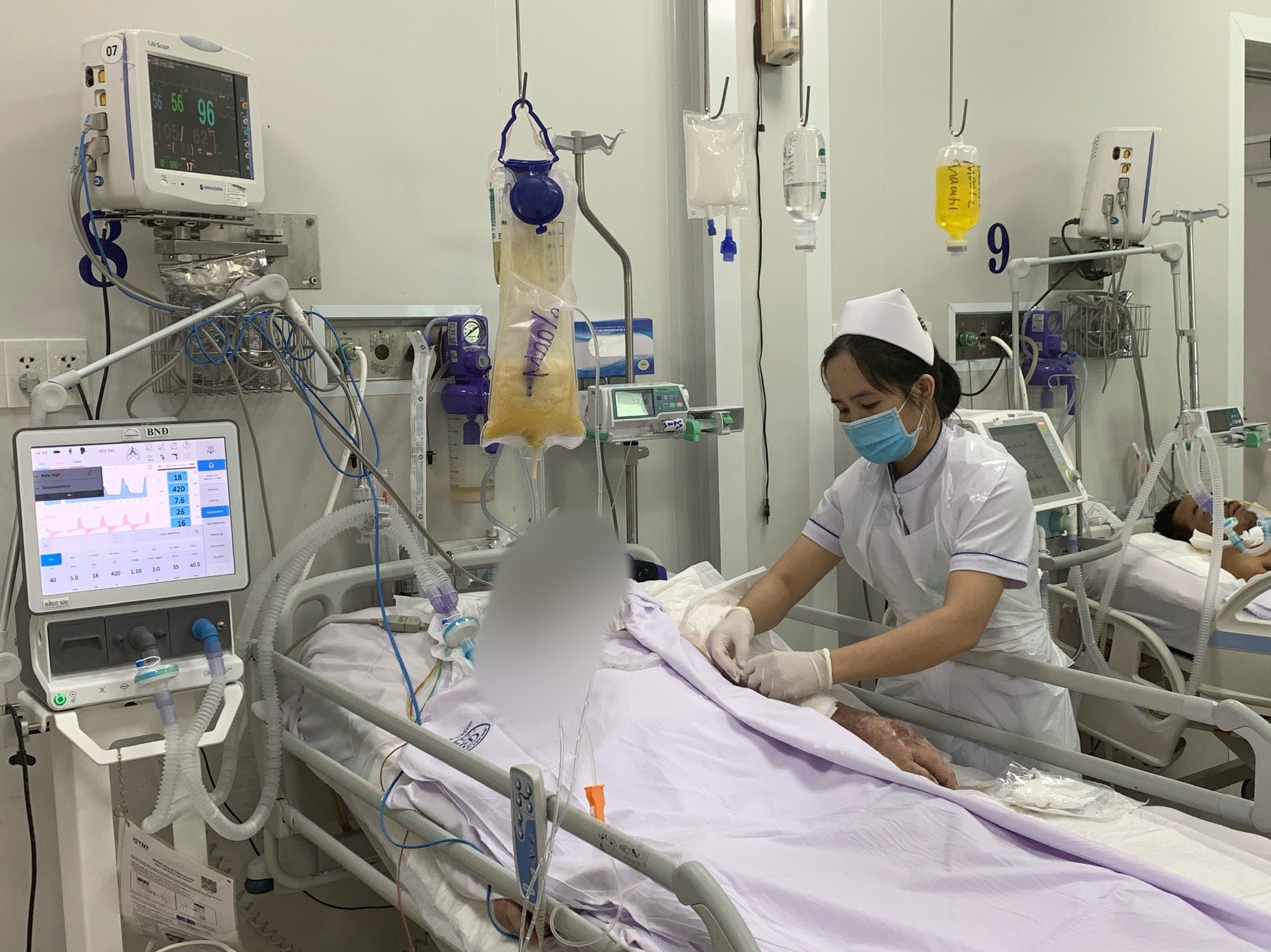 Bệnh nhân điều trị tại bệnh viện sau khi nhiễm độc tố botulinum. Ảnh NLD Bệnh nhân điều trị tại bệnh viện sau khi nhiễm độc tố botulinum. Ảnh NLD