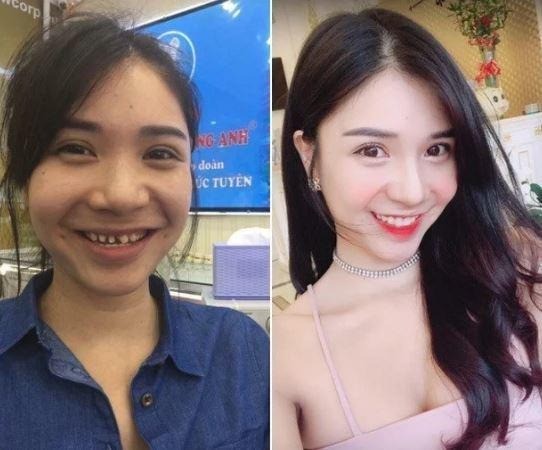 Nhan sắc trước và sau khi trùng tu của Thanh Bi. Ảnh internet Nhan sắc trước và sau khi trùng tu của Thanh Bi. Ảnh internet
