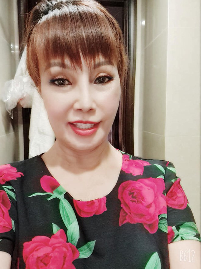 'Cô dâu 62 tuổi' ở Cao Bằng gây sốc khi lộ mặt méo xệch hậu phẫu thuật thẩm mỹ 2
