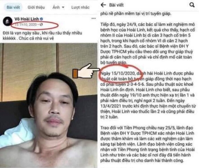 Xuất hiện bản tường trình phẫu thuật của Hoài Linh: Dân tình soi điều bất thường về thời gian 4 Xuất hiện bản tường trình phẫu thuật của Hoài Linh: Dân tình soi điều bất thường về thời gian 4