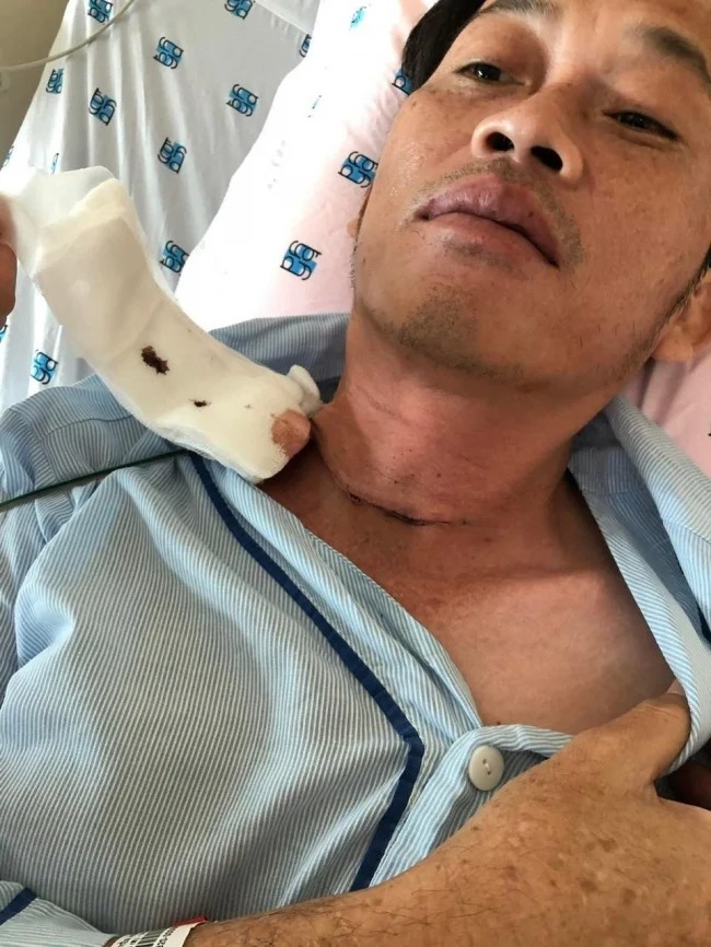 Xuất hiện bản tường trình phẫu thuật của Hoài Linh: Dân tình soi điều bất thường về thời gian 3 Xuất hiện bản tường trình phẫu thuật của Hoài Linh: Dân tình soi điều bất thường về thời gian 3