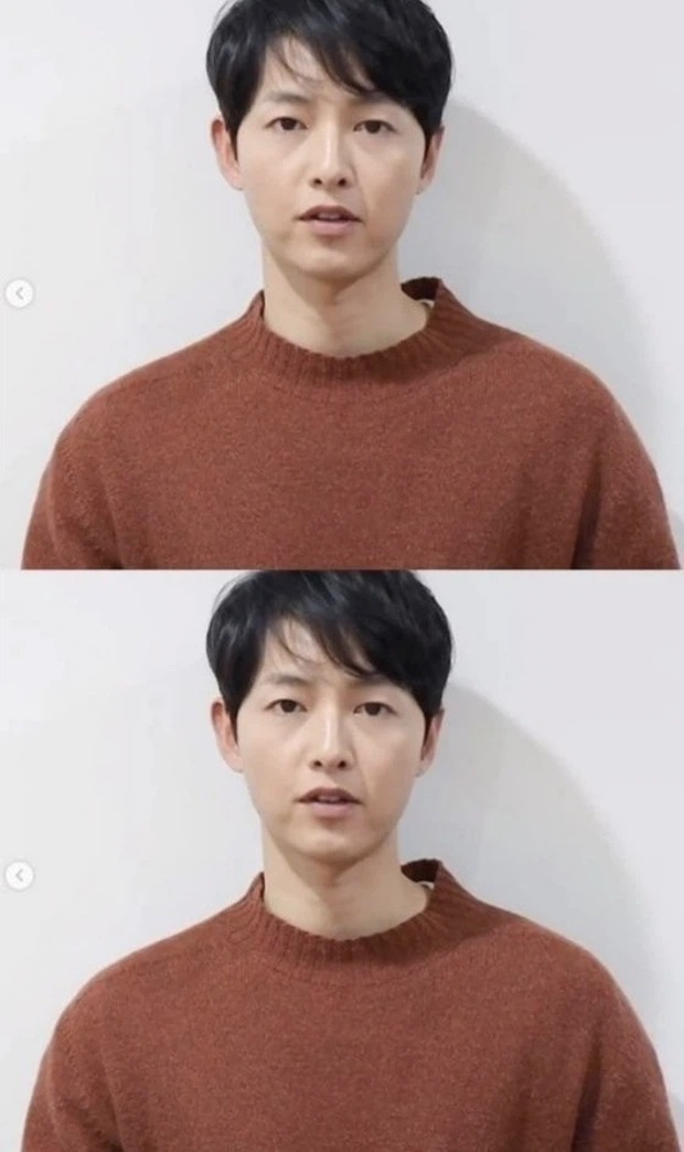 'Lật kèo' nhan sắc, Song Joong Ki khiến fan ngỡ ngàng với gương mặt mộc hoàn hảo 3 'Lật kèo' nhan sắc, Song Joong Ki khiến fan ngỡ ngàng với gương mặt mộc hoàn hảo 3