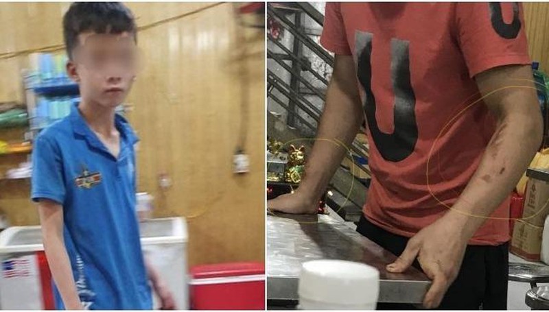 Vụ 2 nhân viên quán bánh xèo bị bạo hành dã man: Đang nuôi con nhỏ, nữ chủ quán có bị phạt tù? 1
