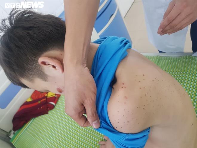 Vụ 2 nhân viên quán bánh xèo bị bạo hành dã man: Đang nuôi con nhỏ, nữ chủ quán có bị phạt tù? 2