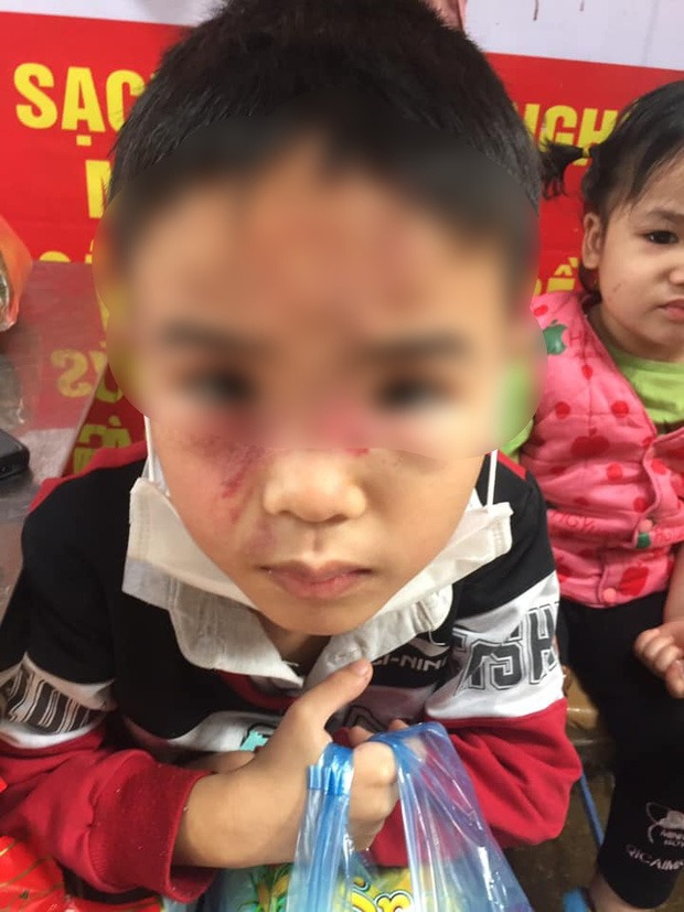 Hà Nội: Bé trai nghi bị bố ruột bạo hành ngày cận Tết khiến dân mạng phẫn nộ 2 Hà Nội: Bé trai nghi bị bố ruột bạo hành ngày cận Tết khiến dân mạng phẫn nộ 2