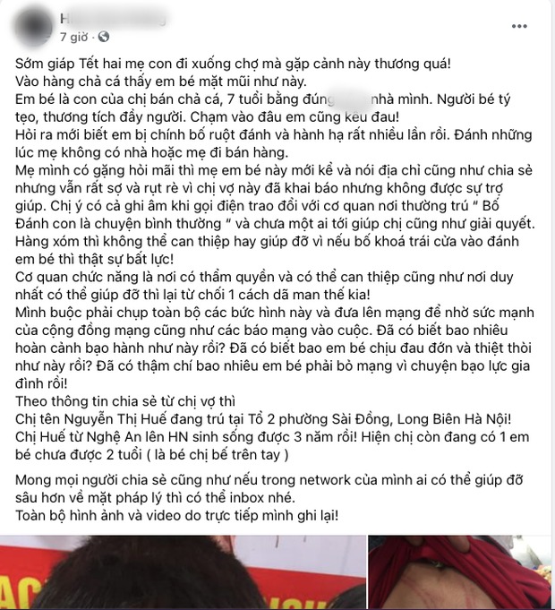 Hà Nội: Bé trai nghi bị bố ruột bạo hành ngày cận Tết khiến dân mạng phẫn nộ 1 Hà Nội: Bé trai nghi bị bố ruột bạo hành ngày cận Tết khiến dân mạng phẫn nộ 1