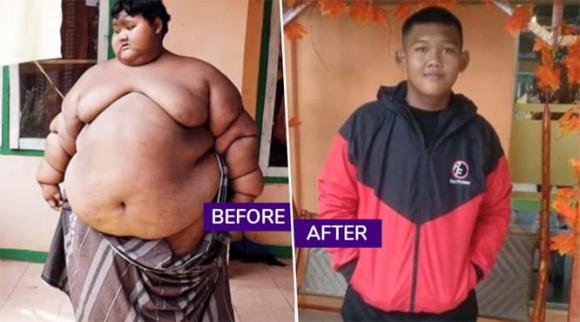 Ngoại hình hiện tại của cậu bé 11 tuổi nặng nhất hành tinh sau khi giảm được 216kg 3 Ngoại hình hiện tại của cậu bé 11 tuổi nặng nhất hành tinh sau khi giảm được 216kg 3