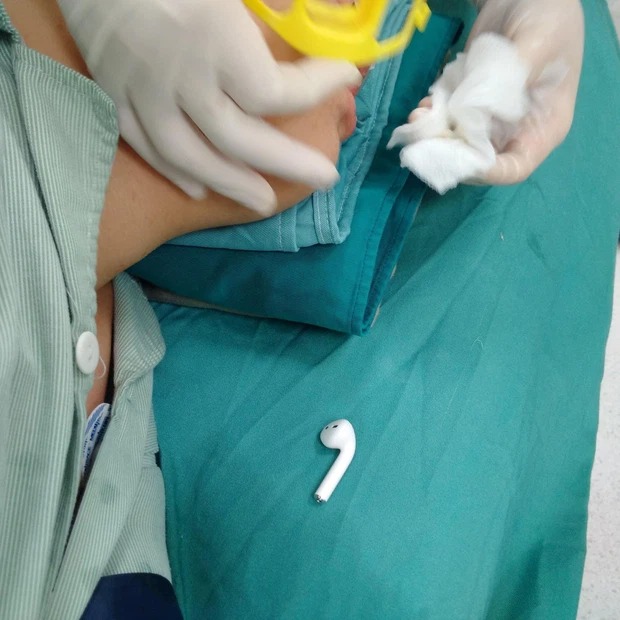 Do nhận thức của trẻ bị hạn chế, trẻ tự kỷ có nguy cơ nuốt các dị vật. Ảnh: FB Do nhận thức của trẻ bị hạn chế, trẻ tự kỷ có nguy cơ nuốt các dị vật. Ảnh: FB