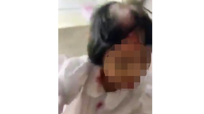 Thanh Hóa: Bé gái 9 tuổi bị mẹ bạo hành, gây thương tích nặng ở vùng đầu 1