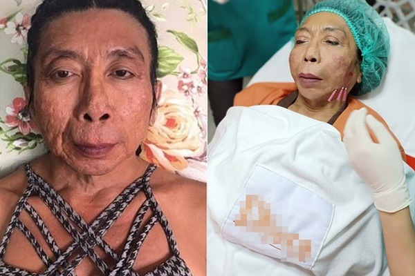 Gái già chuyển giới Thái Lan cả đời 'cua' trai trẻ bất ngờ lộ tình trạng nguy kịch 2 Gái già chuyển giới Thái Lan cả đời 'cua' trai trẻ bất ngờ lộ tình trạng nguy kịch 2