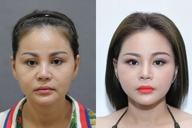 Lê Giang bị 'bóc mẽ' nhan sắc thật hậu thẩm mỹ khi đứng cạnh người em Trấn Thành 4 Lê Giang bị 'bóc mẽ' nhan sắc thật hậu thẩm mỹ khi đứng cạnh người em Trấn Thành 4