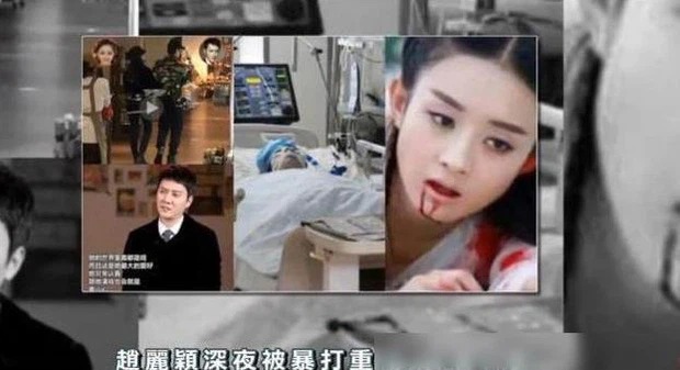 Phía Phùng Thiệu Phong lên tiếng trước nghi vấn ngoại tình, 'ra tay' với Triệu Lệ Dĩnh khiến cô phải nhập viện 3 Phía Phùng Thiệu Phong lên tiếng trước nghi vấn ngoại tình, 'ra tay' với Triệu Lệ Dĩnh khiến cô phải nhập viện 3