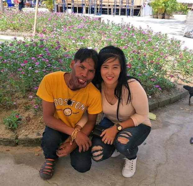 Chàng trai ‘mặt vượn’ ra sao sau 3 năm lấy ‘vợ tiên’, ‘thề non hẹn biển’ đến cuối đời? 1 Chàng trai ‘mặt vượn’ ra sao sau 3 năm lấy ‘vợ tiên’, ‘thề non hẹn biển’ đến cuối đời? 1
