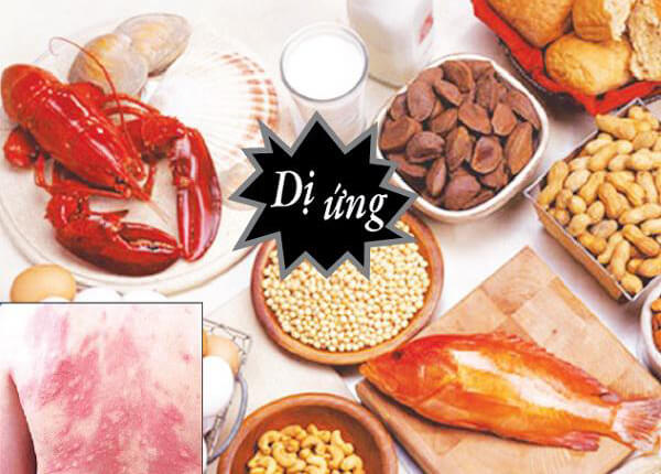 Những vấn đề sức khỏe dễ dàng mắc phải trong ngày Tết cần hết sức cẩn trọng 2 Những vấn đề sức khỏe dễ dàng mắc phải trong ngày Tết cần hết sức cẩn trọng 2