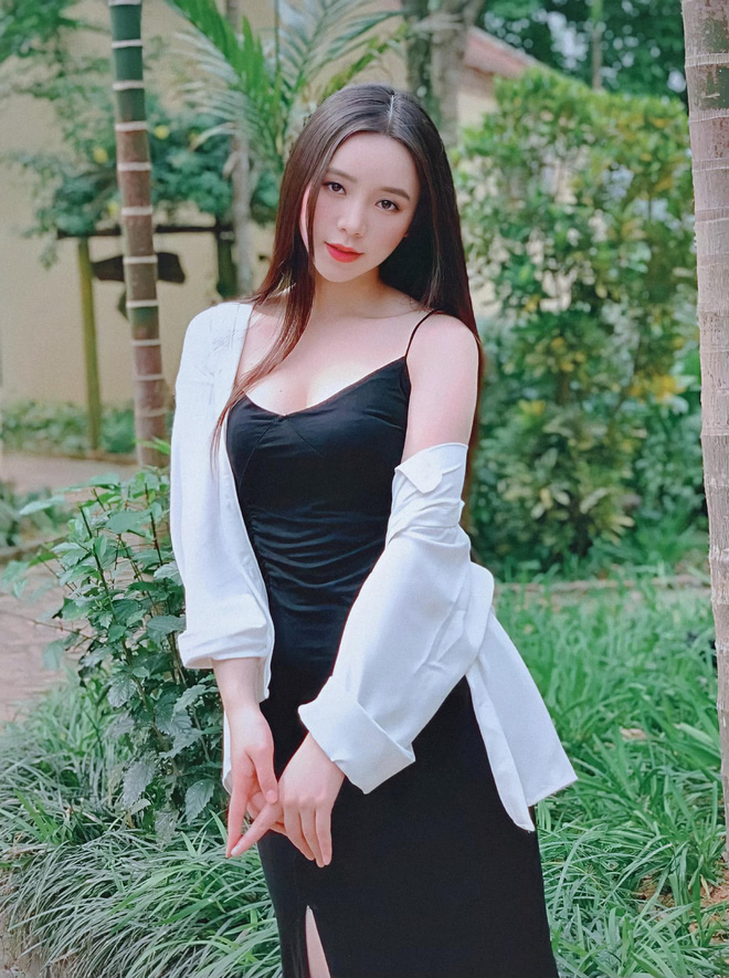 Quỳnh Kool bất ngờ đăng ảnh bị đánh bầm dập, dân tình hốt hoảng chuyện gì đây? 1 Quỳnh Kool bất ngờ đăng ảnh bị đánh bầm dập, dân tình hốt hoảng chuyện gì đây? 1