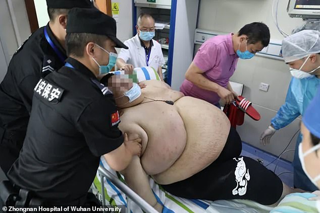 Cách ly chống dịch, thanh niên phải nhập viện khẩn cấp vì tăng 101 kg sau 5 tháng  3