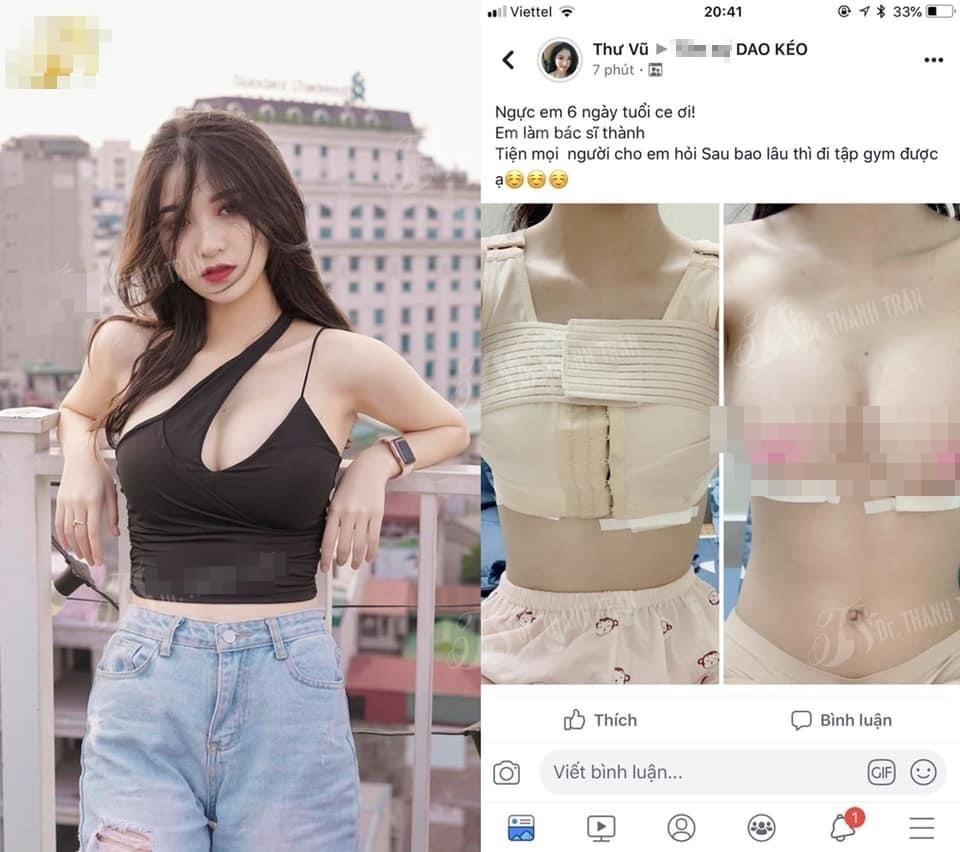 Vũ Thị Anh Thư bị dân tình tìm được loạt ảnh quá khứ, công khai đi PTTM 4 Vũ Thị Anh Thư bị dân tình tìm được loạt ảnh quá khứ, công khai đi PTTM 4