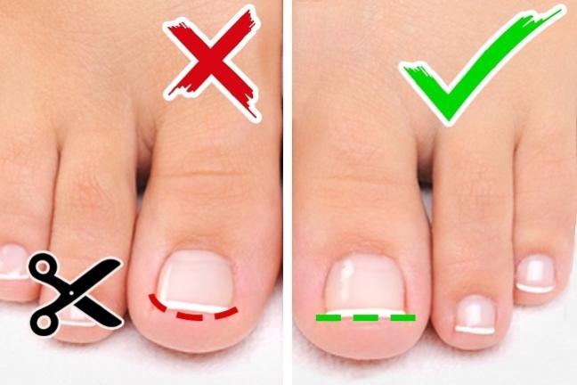 Hãy đến với Mobiletto nails để không còn phạm sai lầm khi cắt móng tay nữa. Chuyên gia của chúng tôi sẽ giúp bạn loại bỏ những sai lầm cơ bản như làm hỏng móng tay, sưng hoặc nhiễm trùng. Thưởng thức một trải nghiệm thật tốt với những bước cắt móng tay chuyên nghiệp và tài năng của chúng tôi.