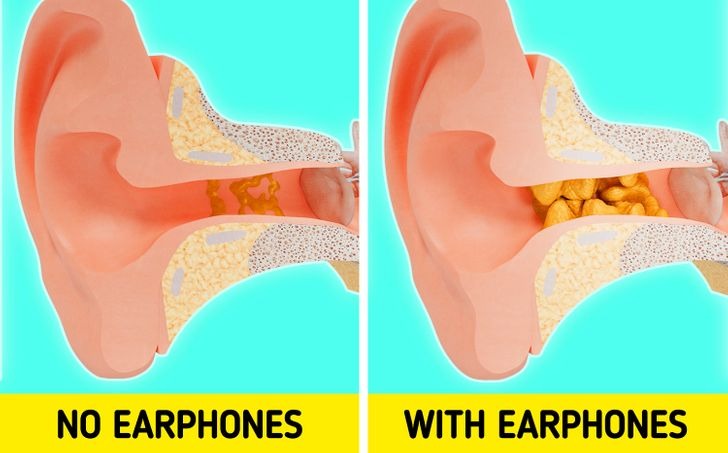 7 tác hại khi đeo tai nghe thường xuyên khiến bạn khóc thét  3
